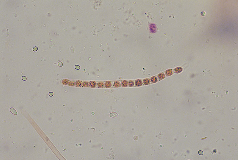Trichoderma gelatinosum